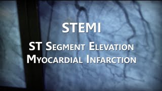 NHRMC Heart Center  STEMI Training Video [upl. by Elttil342]