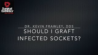 Should I Graft Infected Extraction Sockets [upl. by Ellinger]