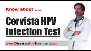 HPV Test Cervista Human Papillomavirus Infection Test in Women [upl. by Benzel]