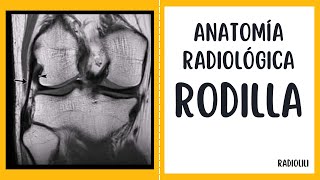 Anatomía Radiológica  Resonancia Magnética Rodilla [upl. by Hgieleak]