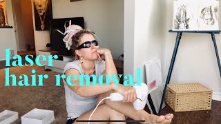 At Home Hair Removal BOSIDIN Laser from AMAZON  UNBOXING plus First Treatment [upl. by Alten46]