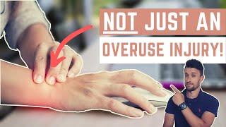 Repetitive Strain Injuries RSI Why Overuse Alone Is Not the Cause [upl. by Leahcim]