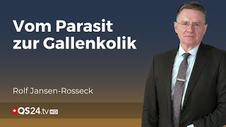 Würmer als Ursache von Gallenkoliken Seltene aber gefährliche Komplikation  QS24 [upl. by Anha]