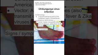 Chikungunya virus infection [upl. by Viehmann173]