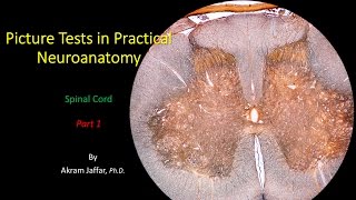 Picture Test in Neuroanatomy  Spinal Cord 1 [upl. by Nyrroc132]