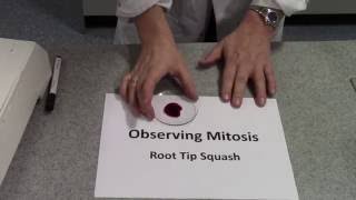 Mitotic Index Root Tip Squash [upl. by Vicky209]