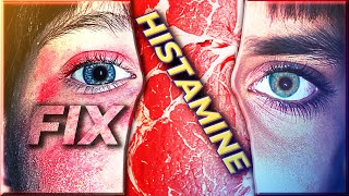 How I fixed my Histamine Intolerance [upl. by Zane]