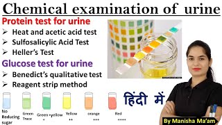 How To Read Urine Test Strips [upl. by Bunch307]