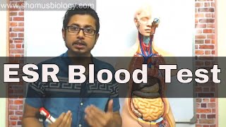 ESR test in Hindi erythrocyte sedimentation rate test [upl. by Jorie]