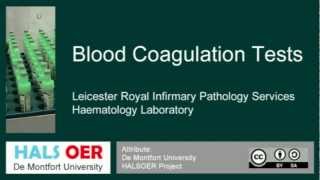 Automated Blood Analyser Part 6 CoagulationTest [upl. by Trahern]