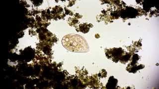 Wimpertierchen  Ciliophora  Ciliata  Ciliate  microorganisms under microscope microcosmos [upl. by Auqinehs]