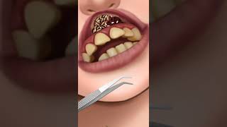 ASMR Mouth  Treatment of the mouth and purification from sepsis  ASMR ANIMATION  shorts asmr [upl. by Munshi244]