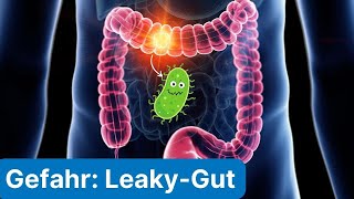 Symptome und Auswirkungen vom Leaky Gut Syndrom [upl. by Remington]