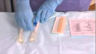 Sample Collection Throat swabs [upl. by Ary]