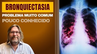 Bronquiectasias problema pulmonar desconhecido mas muito comum [upl. by Idoc]