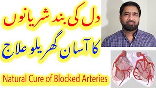 Blocked Arteries Treatment  Blocked Coronary Artery home remedy  Cure Blocked or Clogged arteries [upl. by Aivato977]