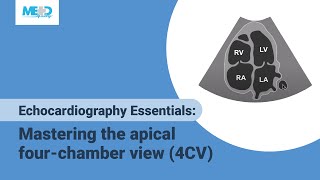 Echocardiography Essentials Mastering the apical fourchamber view 4CV [upl. by Amedeo]