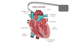 Pacemaker Issues Explained Part 2 Decoding Undersensing [upl. by Emanuel]