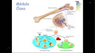 27062017 Síndromes Mielodisplásicos SMD y Leucemia Mieloide Aguda LMA [upl. by Jacinthe]