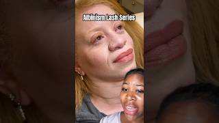 Understanding Albinism SHOWING how to learn and lash behind the scenes lashes [upl. by Towny]