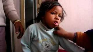 Clinical presentation of Whooping Cough [upl. by Carlyn115]