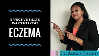 एक्जिमा या चर्म रोग से कैसे निजात पाएं  Effective And Safe Ways To Treat ECZEMA [upl. by Olmsted808]