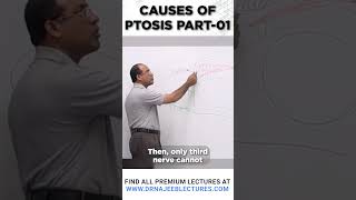 Causes Of Ptosis Part 01 drnajeeblectures drnajeeb shortvideo [upl. by Aicemaj]