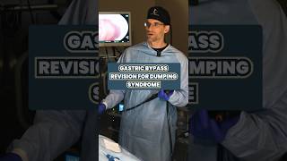 Dumping syndrome post gastric bypass dumpingsyndrome gastricbypasssurgery [upl. by Silisav]