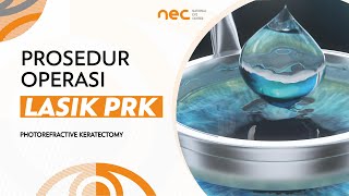 Prosedur Operasi Lasik PRK Photorefractive Keratectomy di National Eye Center [upl. by Tal]