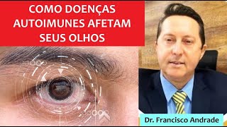 Aula Dr Carlo Von Mulen Como doenças Reumáticas autoimunes afetam seus olhos [upl. by Aerua538]