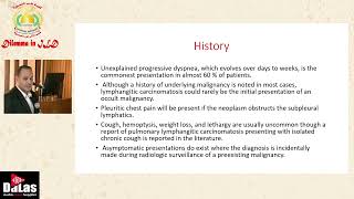 Pulmonary Lymphangitis Carcinomatosis [upl. by Etteloiv]