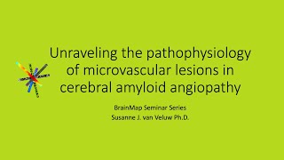 Unraveling the pathophysiology of microvascular lesions in cerebral amyloid angiopathy [upl. by Maddalena]