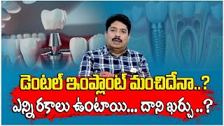 పోయిన పళ్ళకి బెస్ట్ ఆప్షన్  Dental Implant  Types of Dental Implants in Telugu Helthiswelth [upl. by Brom]