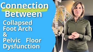 Connection Between Collapsed Foot Arch amp Pelvic Floor Dysfunction FootPain ArchSupport [upl. by Enelyar585]