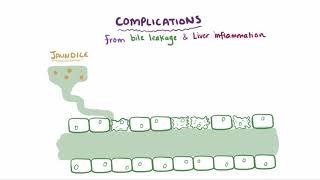 Primary biliary cholangitis causes symptoms diagnosis treatment amp pathology [upl. by Barnett826]