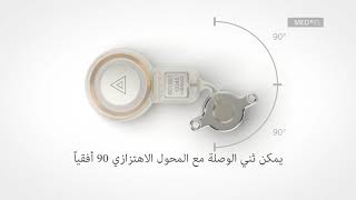 Key Features of the BONEBRIDGE Implant Arabic [upl. by Derina]