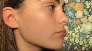 ღ your nose bridge is so smooth and sloped  nasal hump reduction rhinoplasty procedure 💉 [upl. by Aciraa]