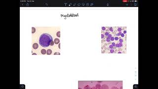 Myeloblast vs lymphoblast [upl. by Adimra]