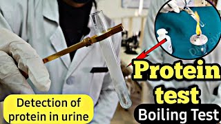 How to use urine test strips 10 parameters [upl. by Ettenor]