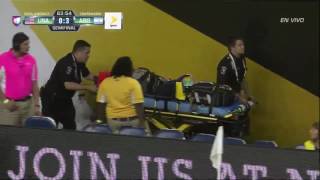 USA vs Argentina 2016 04 increible FRACTURA de Ezequiel Lavezzi [upl. by Nahsor]