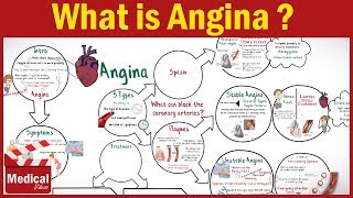 Pharmacology  What is Angina Pectoris  Types of Angina Symptoms Causes ampTreatment FROM A TO Z [upl. by Hurlbut230]