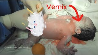 Do you know anything about the vernix layer of newborns [upl. by Anoyek]