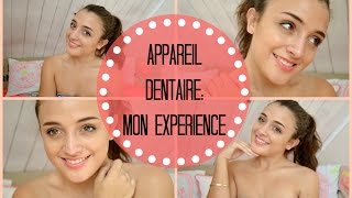 Appareil Dentaire Mon expérience [upl. by Lachance]