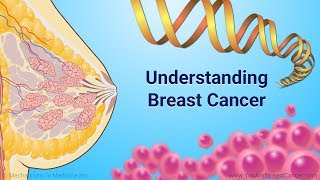 Understanding Breast Cancer [upl. by Eladnek]