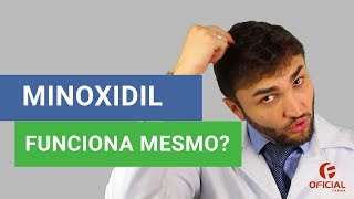 MINOXIDIL FUNCIONA MESMO   Oficial Farma [upl. by Ob40]