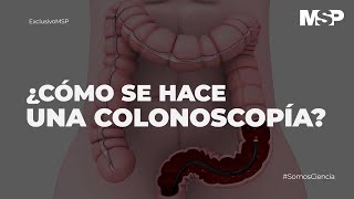 ¿Cómo se hace una colonoscopía ExclusivoMSP [upl. by Sido302]