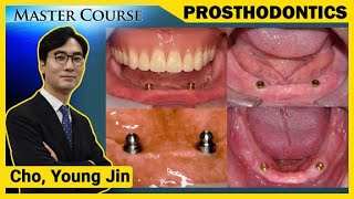 Master Course Season2 PROSTHODONTICS Solitary type Overdenture [upl. by Gowon165]