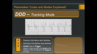 Pacemaker Codes and Modes  Explained [upl. by Kaitlynn958]