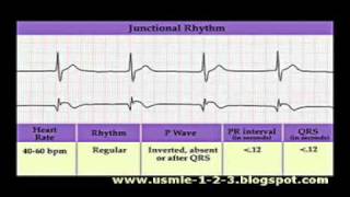 ECG Sinus Atrial Junctional Rhythms [upl. by Aneeh]