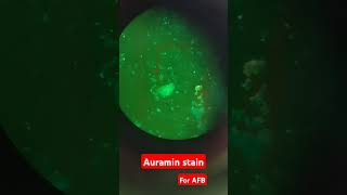 Auramin stain for AFB under fluorescent microscope [upl. by Bazluke824]